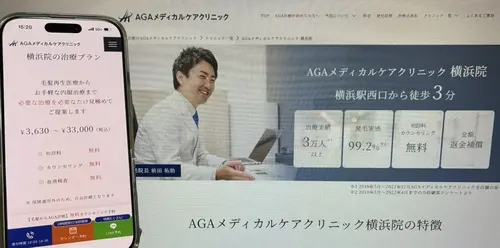 AGAメディカルケアクリニックのAGA治療