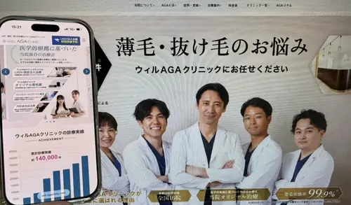 ウィルAGAクリニックのAGA治療