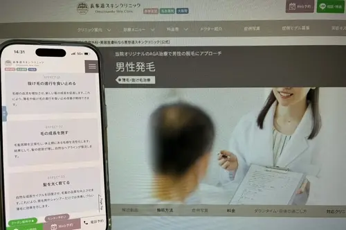 表参道スキンクリニックのAGA治療