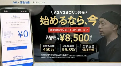 ゴリラクリニックのAGA治療