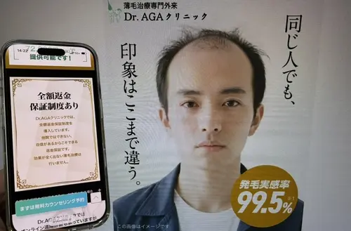 Dr.AGAクリニックのAGA治療