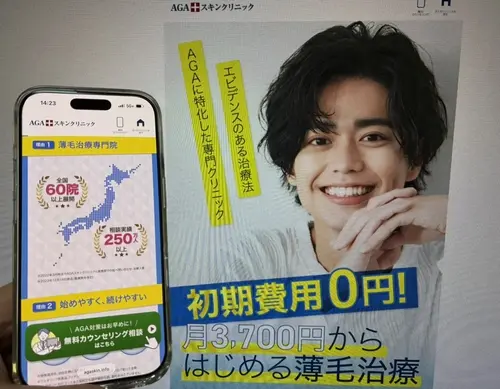 AGAスキンクリニックのAGA治療