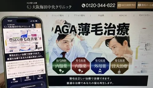 大阪梅田中央クリニックのAGA治療