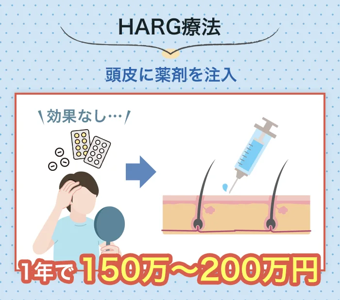HARG（ハーグ）療法でAGA治療をした場合の費用目安は150～200万円