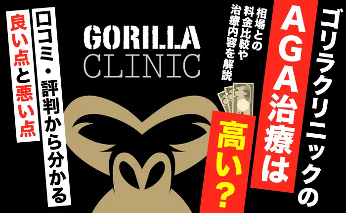 ゴリラクリニックのAGA治療は高い？相場との料金比較や治療内容を解説