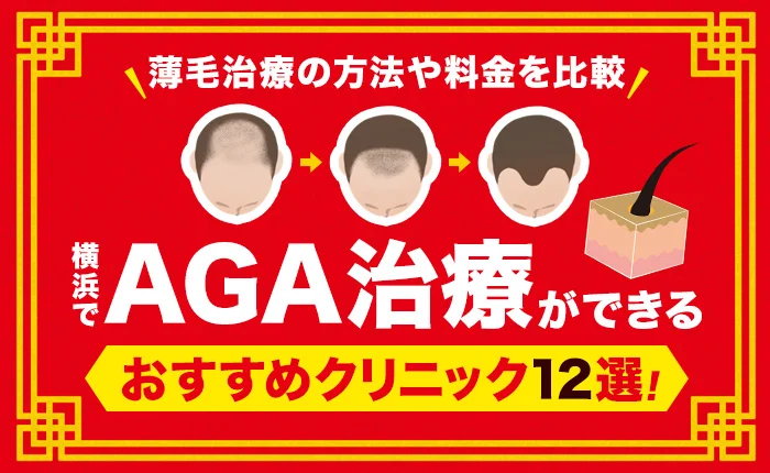 横浜でAGA治療ができるおすすめクリニック12選｜費用が安い薄毛治療