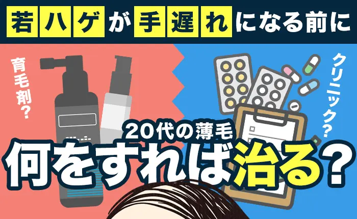 20代の薄毛は何が原因で、何をすれば治る？若ハゲが手遅れになる前に